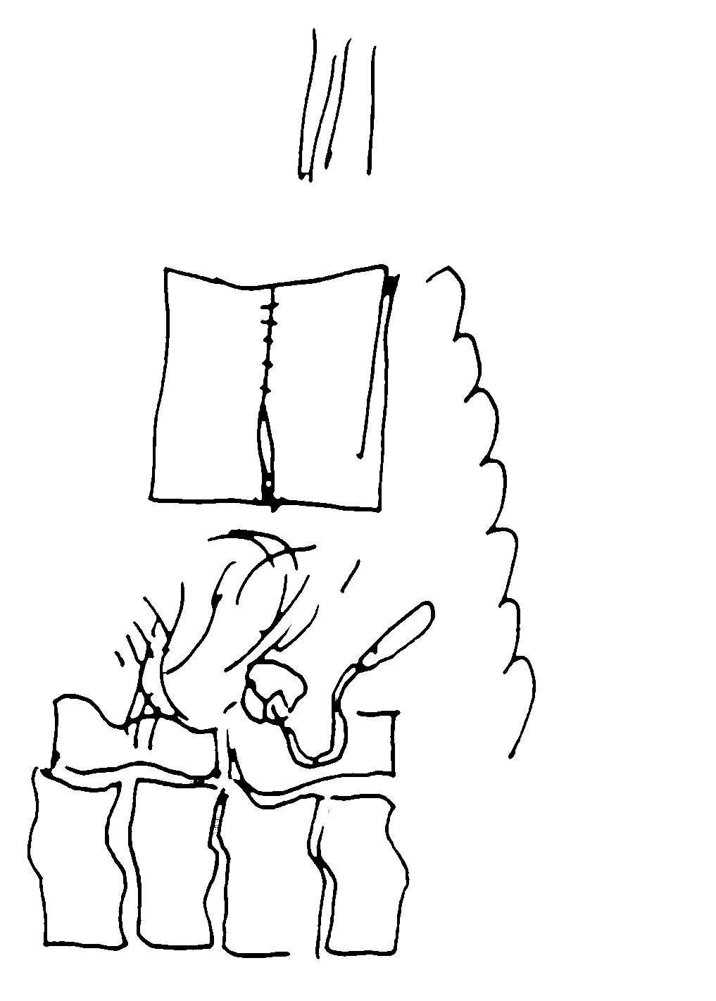 - un poumon, le dessin- page 25